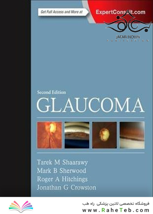 Glaucoma: 2-Volume Set 2nd Edition2014 گلوکوم: مجموعه 2 جلدی