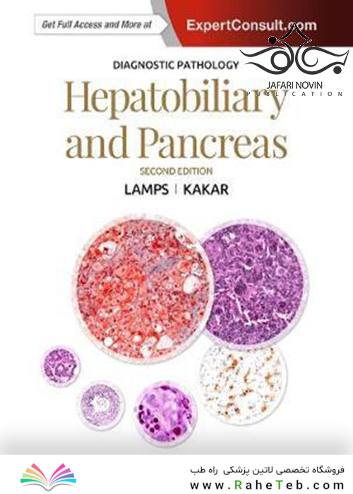 Diagnostic Pathology: Hepatobiliary and Pancreas 2nd Edition2016 آسیب شناسی تشخیصی: کبد و صفراوی