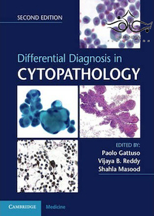 عکس Differential Diagnosis in Cytopathology, 2nd Edition2015 تشخیص افتراقی در سیتوپاتولوژی