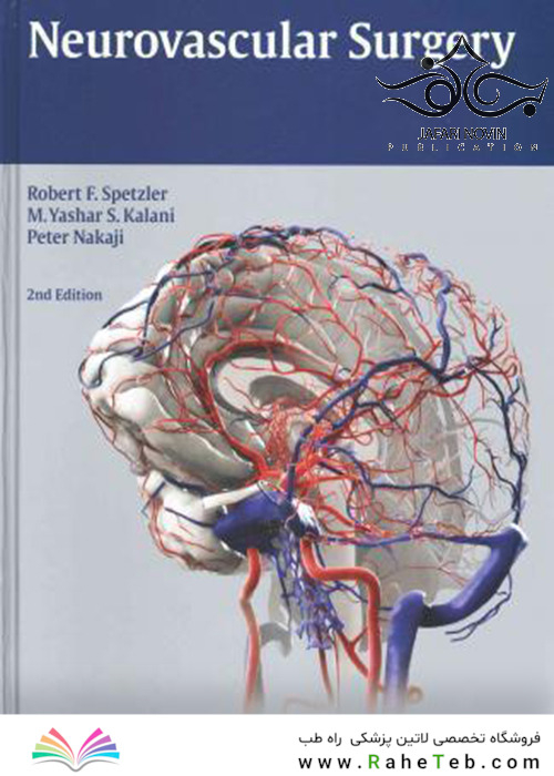 Neurovascular Surgery 2nd Edition2015