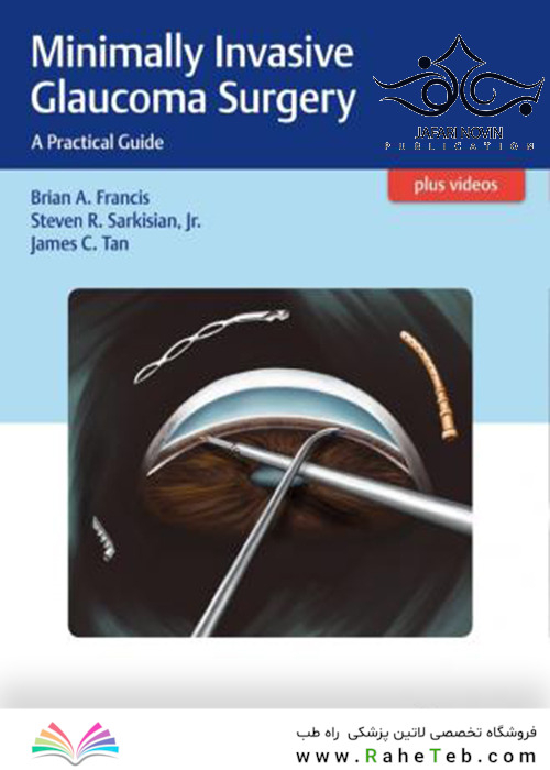 Minimally Invasive Glaucoma Surgery2017 جراحی گلوکوم حداقل تهاجمی