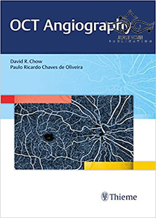 عکس OCT Angiography 1st Edition2017 آنژیوگرافی OCT