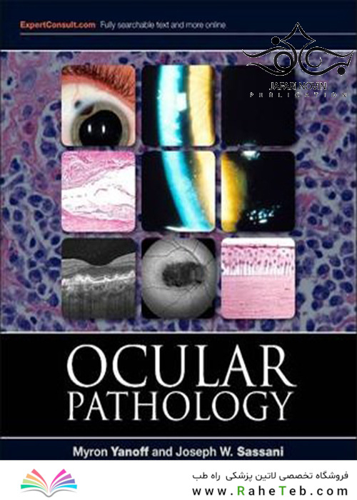 Ocular Pathology, 7th Edition2014 آسیب شناسی چشم