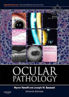 عکس Ocular Pathology, 7th Edition2014 آسیب شناسی چشم