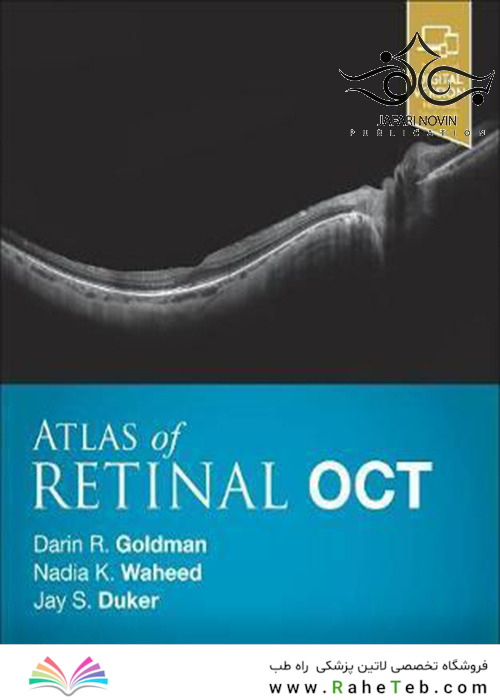 Atlas of Retinal OCT: Optical Coherence Tomography 1st Edition2018 اطلس توموگرافی انسجام نوری شبکیه