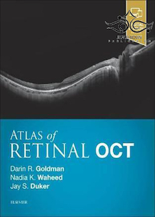عکس Atlas of Retinal OCT: Optical Coherence Tomography 1st Edition2018 اطلس توموگرافی انسجام نوری شبکیه