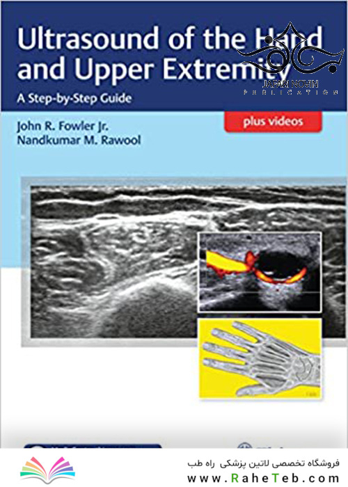 Ultrasound of the Hand and Upper Extremity2017 سونوگرافی دست و اندام فوقانی