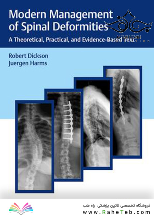 Modern Management of Spinal Deformities2017 ناهنجاری های ستون فقرات