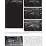 Fundamentals of Musculoskeletal Ultrasound 3rd Edition 2017
