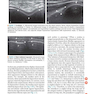 Fundamentals of Musculoskeletal Ultrasound 3rd Edition 2017