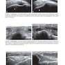 Fundamentals of Musculoskeletal Ultrasound 3rd Edition 2017