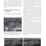 Fundamentals of Musculoskeletal Ultrasound 3rd Edition 2017