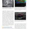 Fundamentals of Musculoskeletal Ultrasound 3rd Edition 2017