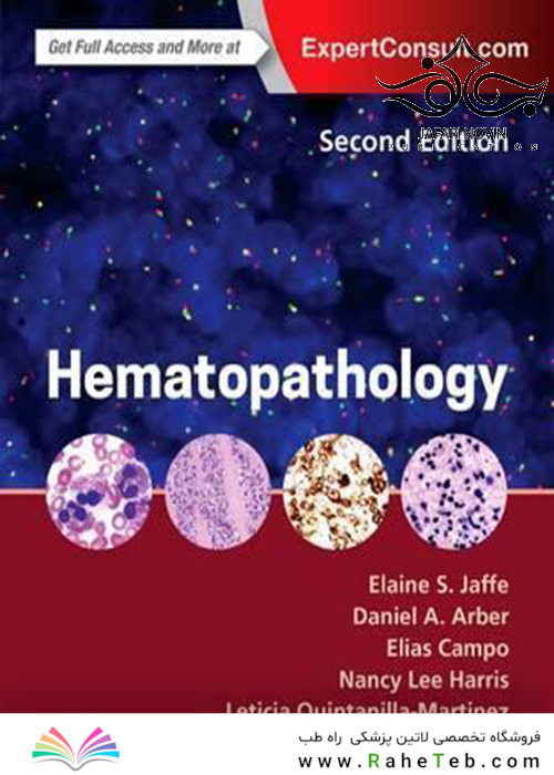 Hematopathology, 2nd Edition 2016