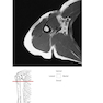 Pocket Atlas of Sectional Anatomy, Volume III, 2nd Edition 2017