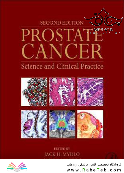 Prostate Cancer: Science and Clinical Practice 2nd Edition2015 سرطان پروستات