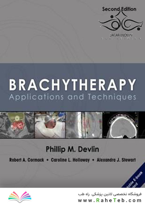 Brachytherapy, Second Edition: Applications and Techniques 2nd Edition2015 براکی تراپی