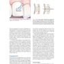 Clear Aligner Technique, 1st Edition 2018