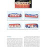 Clear Aligner Technique, 1st Edition 2018