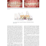 Clear Aligner Technique, 1st Edition 2018