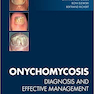 Onychomycosis: Diagnosis and Effective Management 1st Edition2018