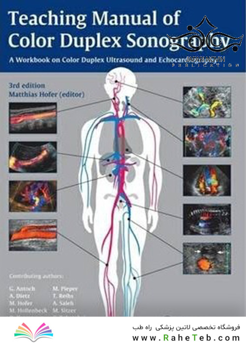 Teaching Manual of Color Duplex Sonography, 3rd Edition 2010