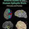 Invasive Studies of the Human Epileptic Brain2019 مطالعات تهاجمی مغز صرعی انسان