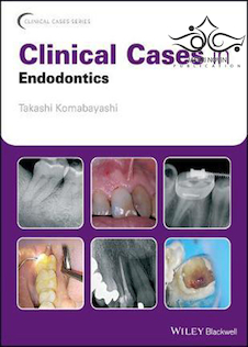 عکس Clinical Cases in Endodontics, 1st Edition2018 موارد بالینی در اندودنتیکس