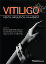 Vitiligo: Medical and Surgical Management 1st Edition2018 ویتیلیگو: مدیریت پزشکی و جراحی