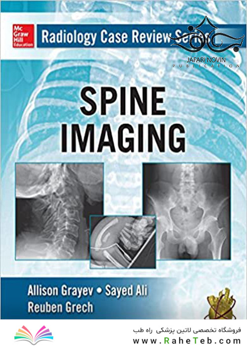 Radiology Case Review Series: Spine2015 مجموعه بررسی موارد رادیولوژی: ستون فقرات