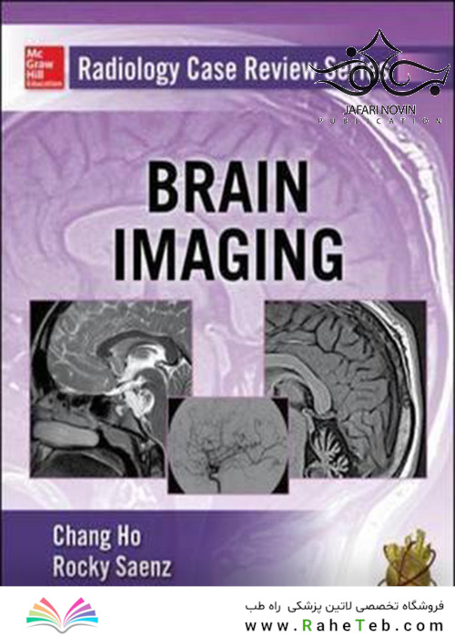 Radiology Case Review Series: Brain Imaging 1st Edition