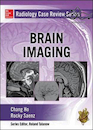 Radiology Case Review Series: Brain Imaging 1st Edition