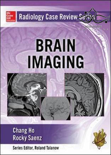 عکس Radiology Case Review Series: Brain Imaging 1st Edition