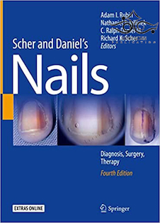 عکس Scher and Daniel’s Nails: Diagnosis, Surgery, Therapy, 4th Edition2018  تشخیص ، جراحی ، درمان ناخن