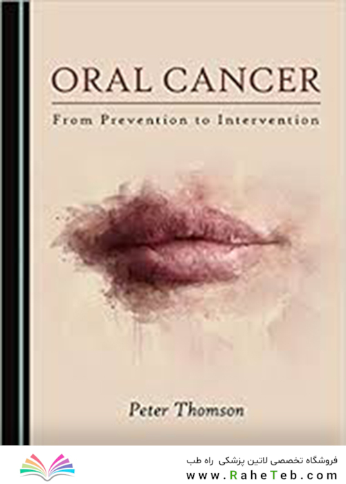 Oral Cancer, 1st Edition2019 سرطان دهان
