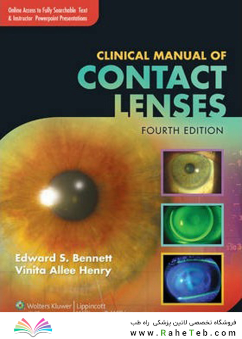Clinical Manual of Contact Lenses, Fourth Edition2013 راهنمای بالینی لنزهای تماسی