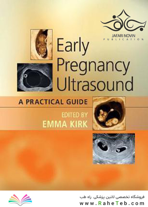Early Pregnancy Ultrasound: A Practical Guide 1st Edition2017 سونوگرافی در اوایل بارداری