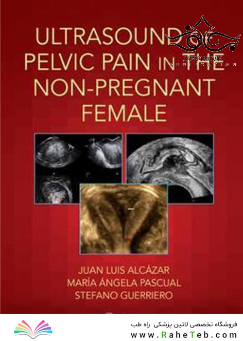 Ultrasound of Pelvic Pain in the Non-Pregnant Patient2019 سونوگرافی درد لگن در بیمار غیر باردار