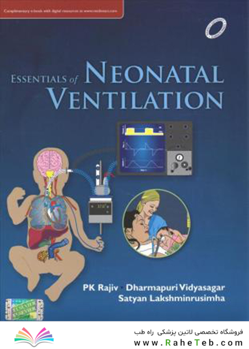 Essentials of Neonatal Ventilation, 1st Edition2019