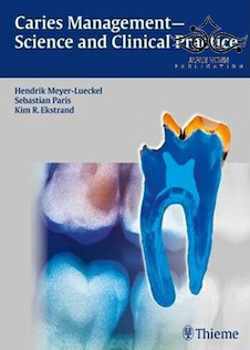 عکس Caries Management – Science and Clinical Practice 1st Edition2020 مدیریت پوسیدگی - علم و عمل بالینی
