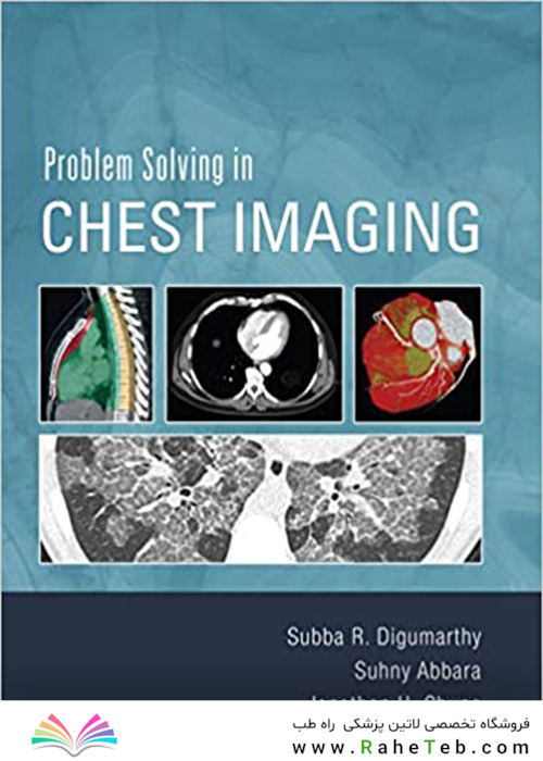 Problem Solving in Chest Imaging, 1st Edition2019 حل مسئله در تصویربرداری قفسه سینه