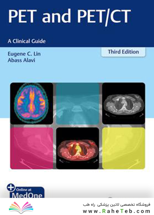 PET and PET/CT: A Clinical Guide 3rd Edition2019