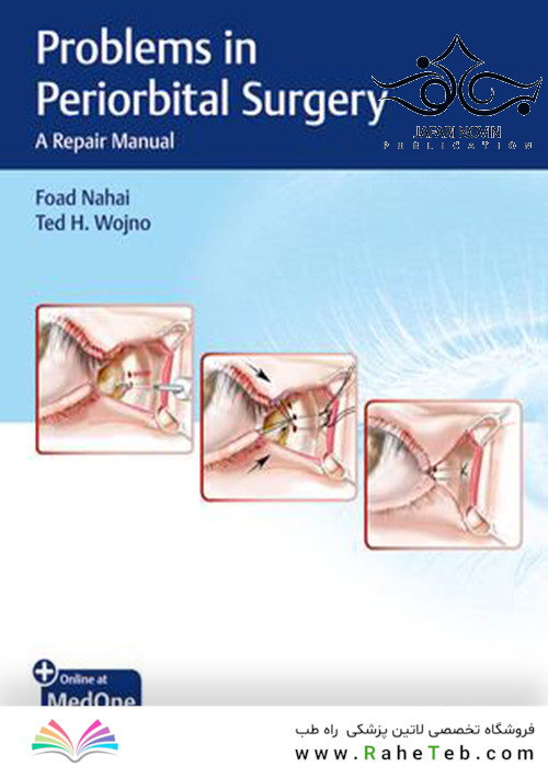 Problems in Periorbital Surgery: A Repair Manual2019 مشکلات جراحی قدامی: یک راهنمای ترمیم