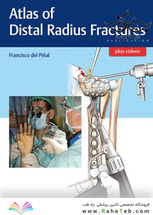 Atlas of Distal Radius Fractures 1st Edition2018 شکستگی های دیستال رادیوس
