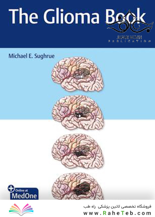The Glioma Book 1st Edition2020 گلیوما