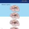 The Glioma Book 1st Edition2020 گلیوما