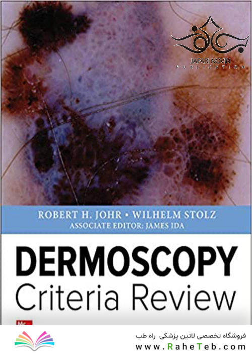 Dermoscopy Criteria Review 1st Edition2019