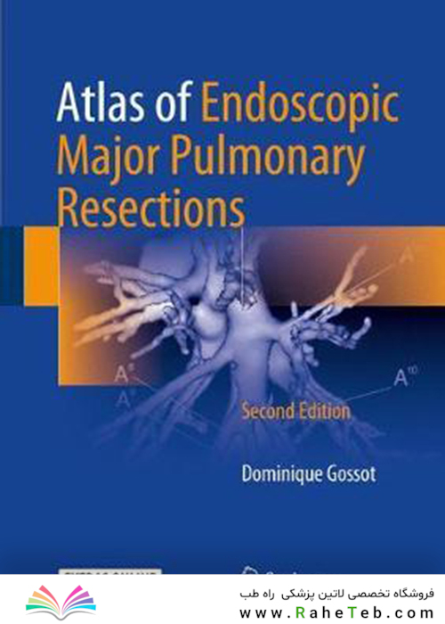 Atlas of Endoscopic Major Pulmonary Resections 2nd Edition2017 اطلس برداشت های عمده ریوی آندوسکوپی