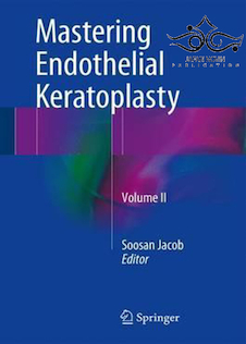 عکس Mastering Endothelial Keratoplasty, Volume II 1st Edition2016 تسلط بر کراتوپلاستی اندوتلیال ، جلد دوم