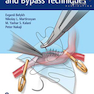 Microsurgical Basics and Bypass Techniques 1st Edition12020